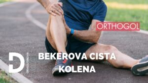 bekerova cista kolena, poplitealna cista, baker cista