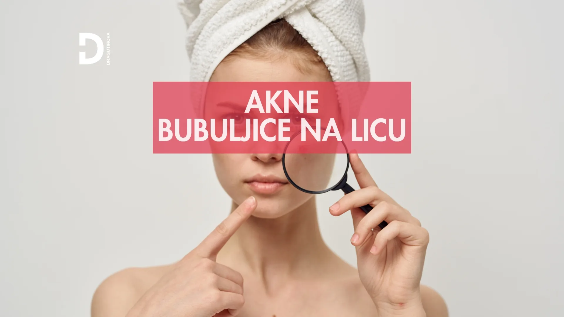 akne i bubuljice na licu bubuljica lečenje roakutan - Dragutinova akne i bubuljice na licu bubuljica lečenje roakutan