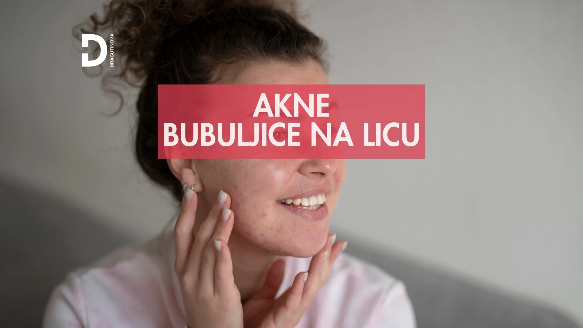 akne i bubuljice na licu ceđenje krema losion lečenje potkožne bubuljice - Dragutinova akne i bubuljice na licu ceđenje krema losion lečenje potkožne bubuljice