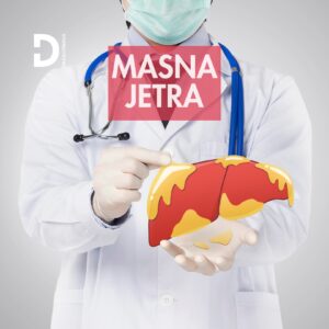 masna jetra steatosis hepatis steatoza jetre