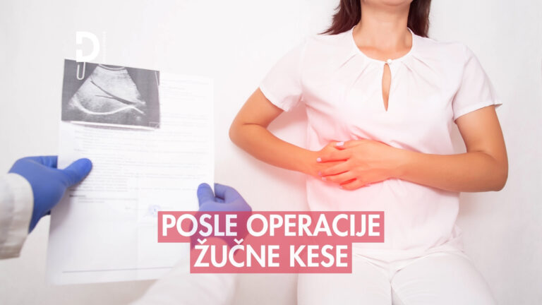 ishrana i aktivnosti posle operacije žučne kese