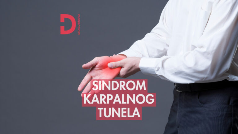 karpalni tunel sindrom karpalnog tunela narodni lek krema lečenje