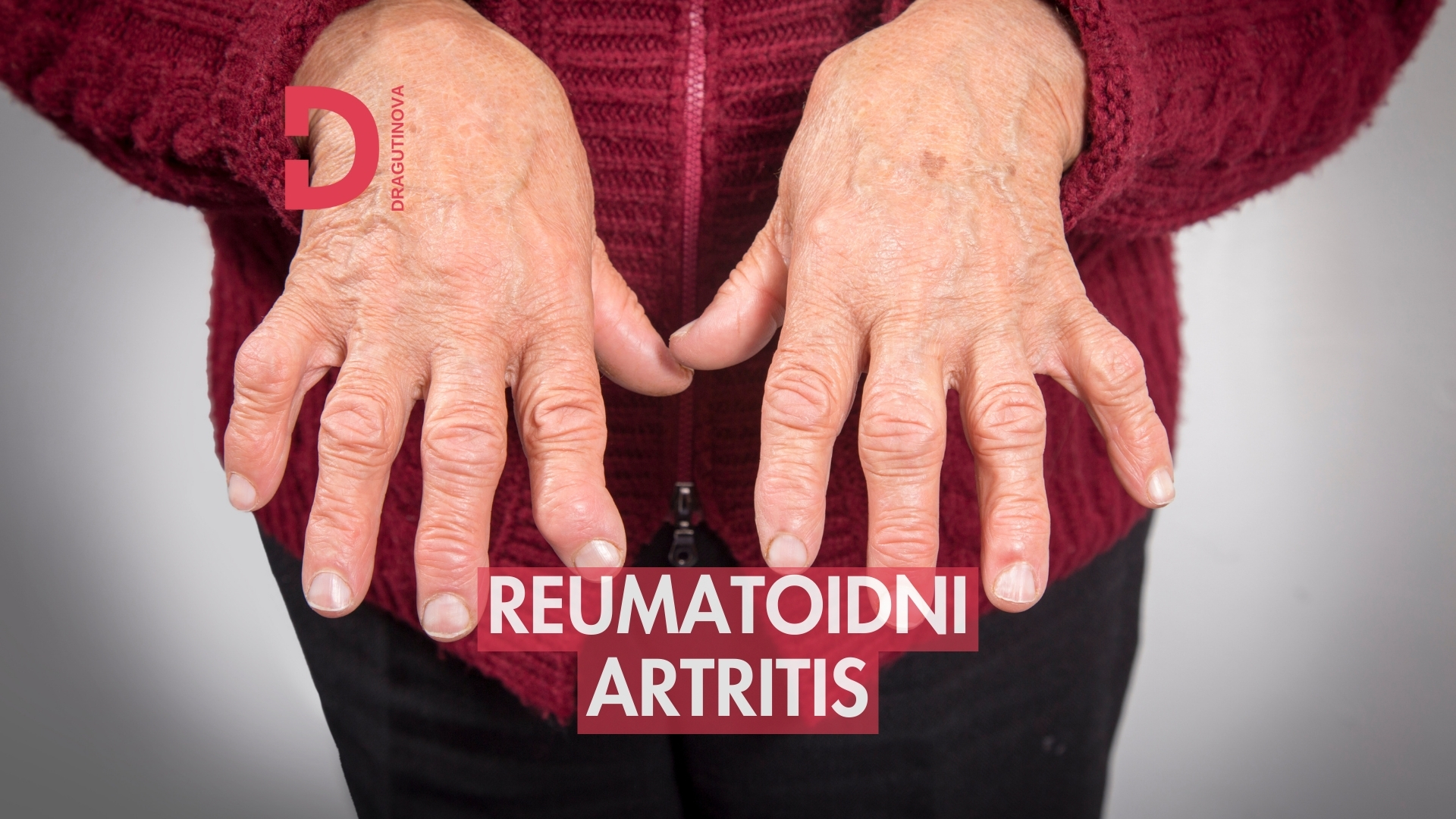 reumatoidni artritis