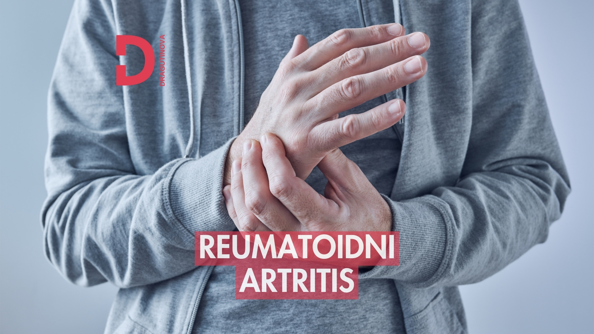 reumatoidni artritis, simptomi, znaci artritisa, biološka terapija, najbolji lek za artritis