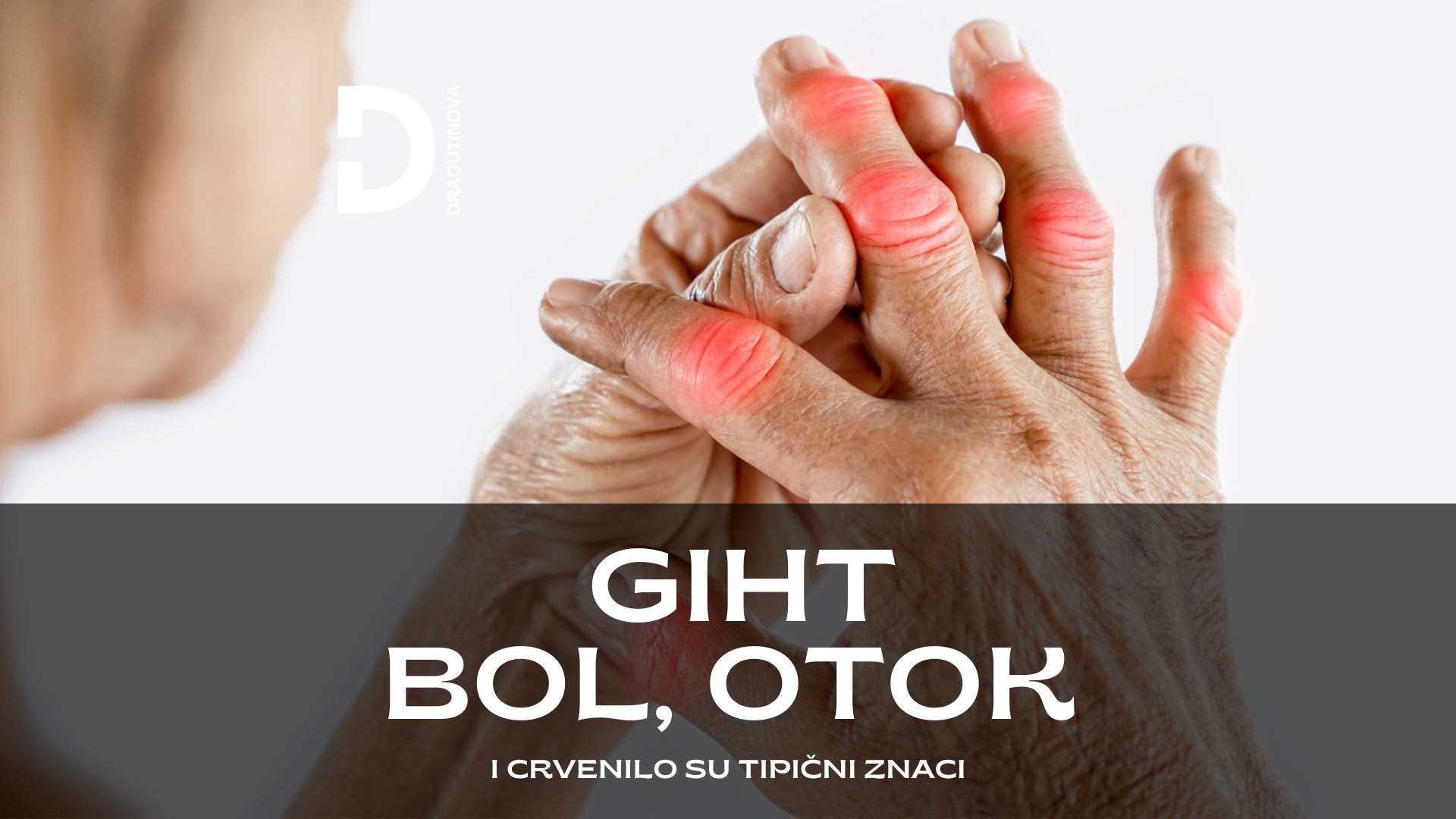 giht, šta je giht, giht uzroci, giht simptomi, mokraćna kiselina, slike gihta, giht je, giht slike, giht na nozi, giht lečenje, giht na nozi slike, lekovi za giht, lek za giht,najbolje tablete za giht