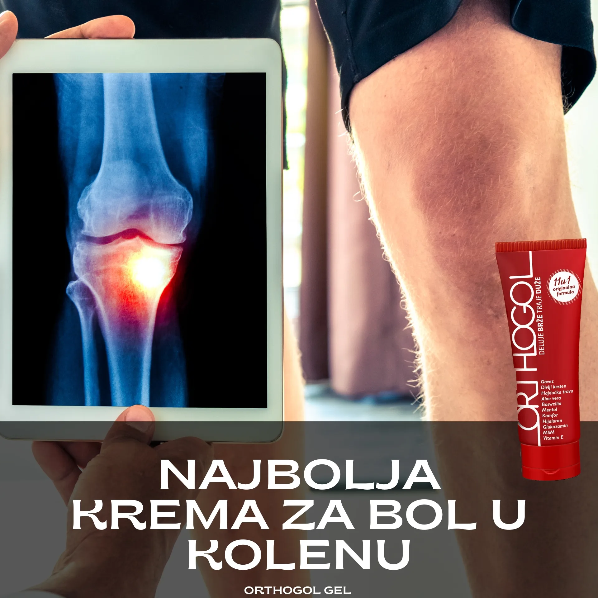 najbolja krema za bol u kolenu najbolja mast za artritis bol u kolenu najbolji gel protiv bolova najbolja krema za otok 1 najbolja krema za bol u kolenu najbolja mast za artritis bol u kolenu najbolji gel protiv bolova najbolja krema za otok