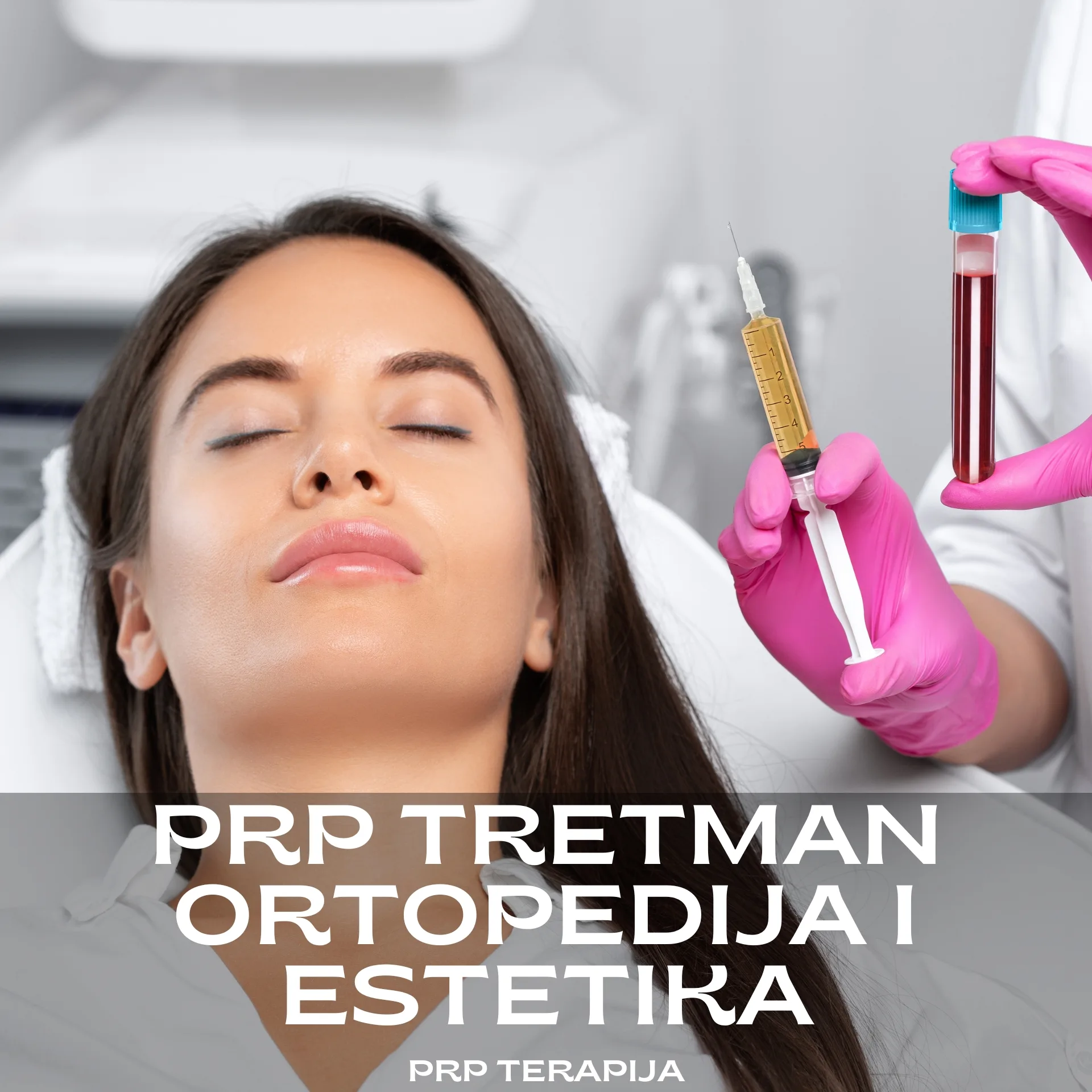 prp tretman kolena kose lica, prp terapija krvna plazma obogaćena trombocitima - Dragutinova prp tretman kolena kose lica, prp terapija krvna plazma obogaćena trombocitima