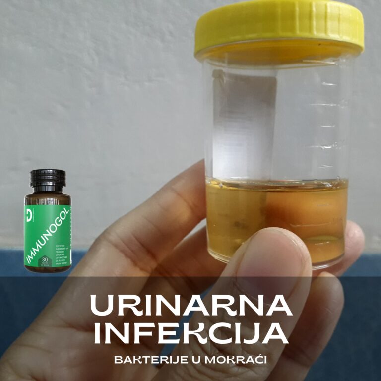 urinarna infekcija, bakterije u mokraci, bakterije u urinu, infekcija urinarnog trakta, dosta bakterija u urinu, Urinarna infekcija simptomi, opasne bakterije u mokraci