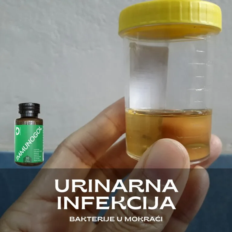 urinarna infekcija, bakterije u mokraci, bakterije u urinu, infekcija urinarnog trakta, dosta bakterija u urinu, Urinarna infekcija simptomi, opasne bakterije u mokraci