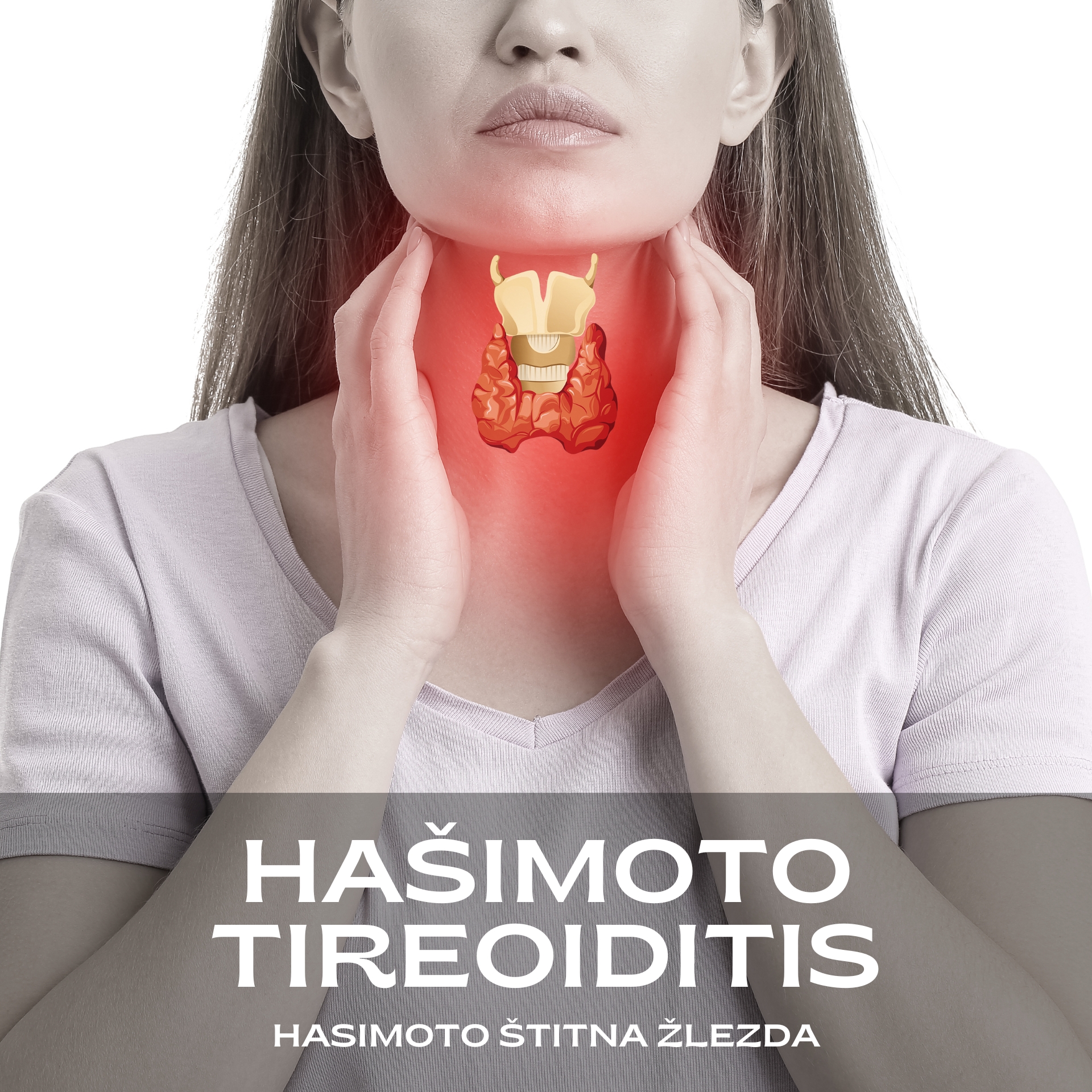 Hašimoto tireoiditis, hasimoto lečenje, hašimoto simptomi, hasimoto bolest